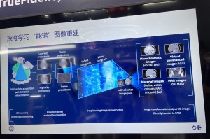 當AI遇上能譜技術，CT影像如何從雪花屏變“4K”？